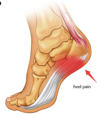 what causes heel pain ?